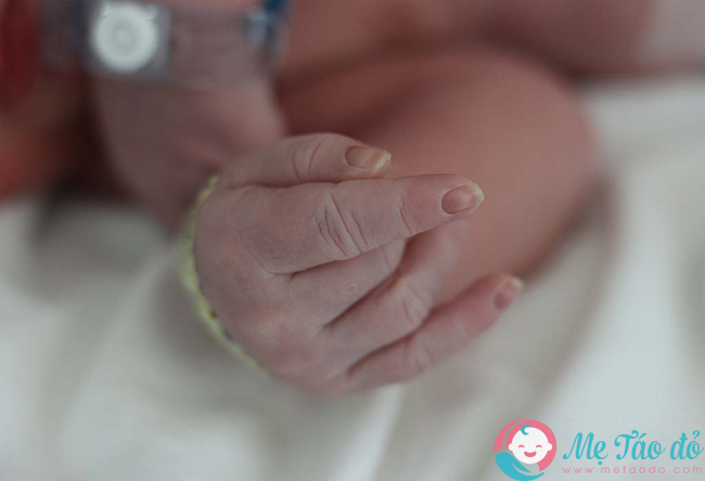 8 căn bệnh về da phổ biến trẻ sơ sinh nào cũng dễ mắc, các mẹ đang nuôi con nhỏ nên lưu ý - Ảnh 1.