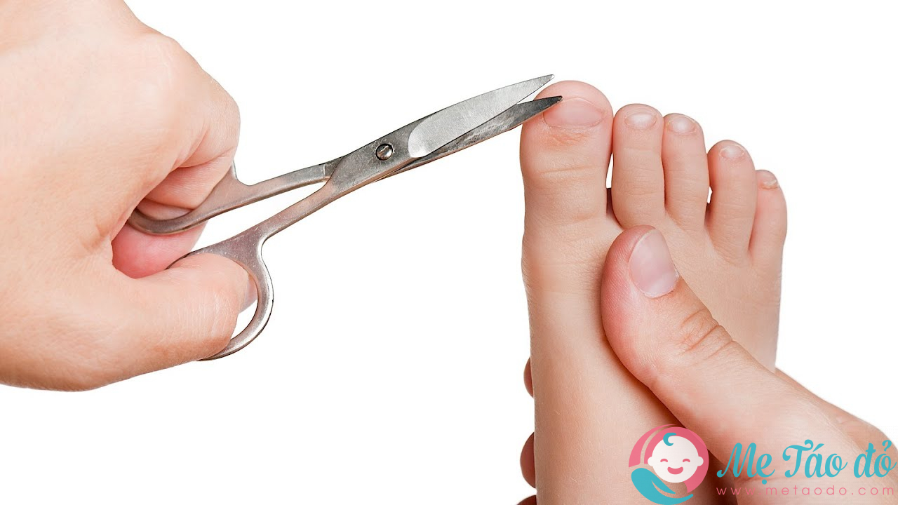 Phải làm gì để khắc phục bệnh nấm móng chân ở trẻ?