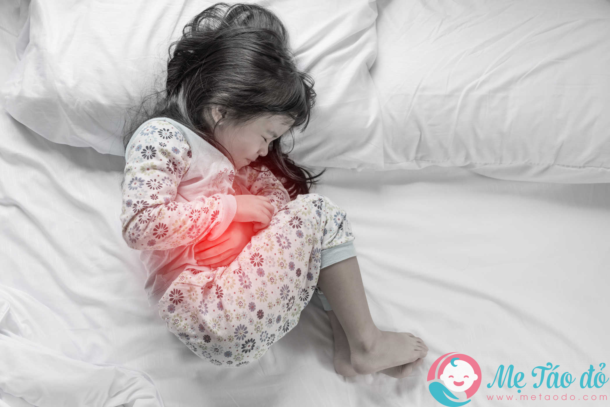 Hội chứng ruột kích thích ở trẻ là gì?