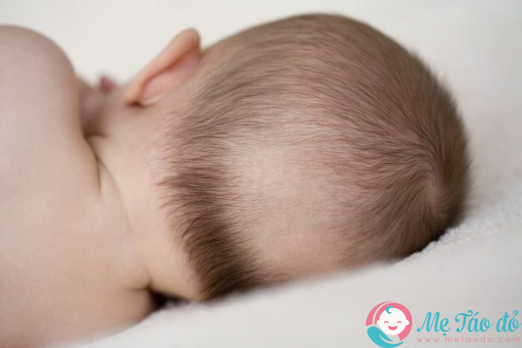 trẻ sơ sinh bị rụng tóc trong 6 tháng đầu